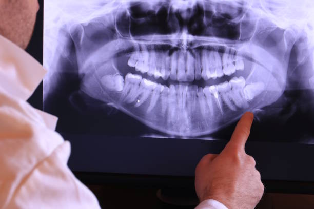Best Walk-In Emergency Dentist in Teutopolis, IL