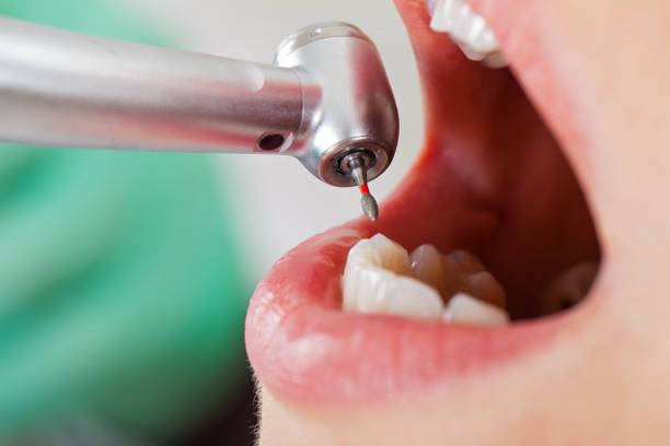 Best Emergency Treatment for Toothache in Teutopolis, IL